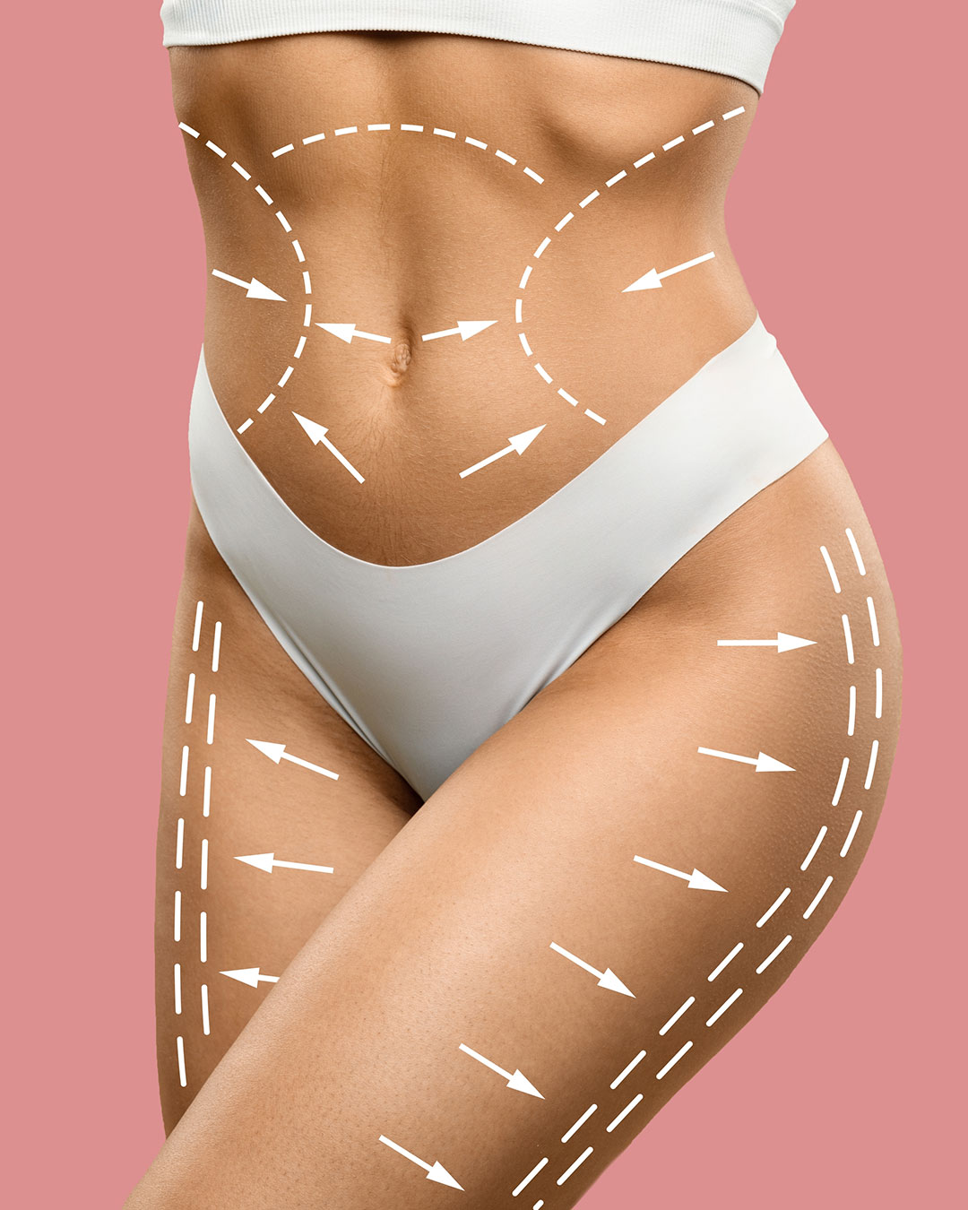 Bodylift im Kuzbari Zentrum Wien