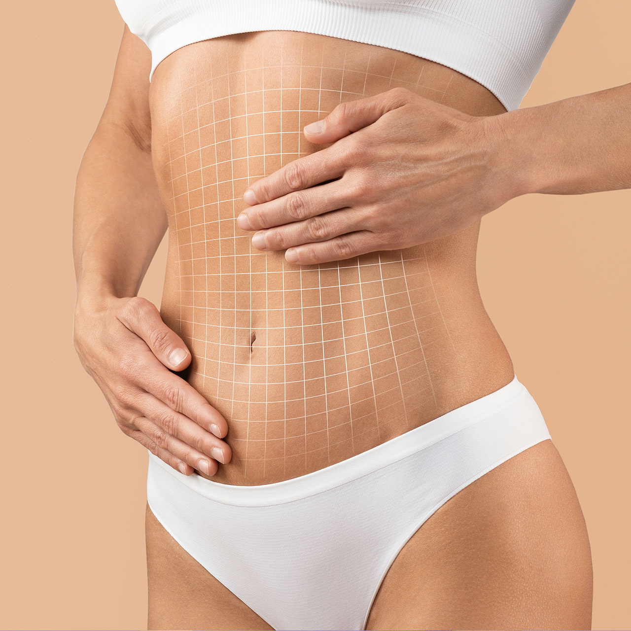 Bauchdeckenstraffung (Abdominoplastik)