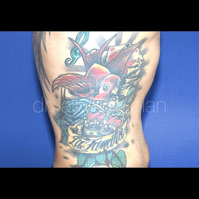 Fettabsaugung, 35 Vorher Nachher