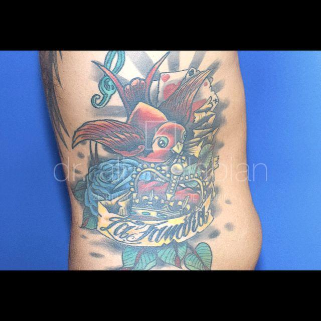 Fettabsaugung, 35 Vorher Nachher